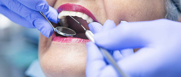 Best Emergency Root Canal Therapy in Washington, NJ